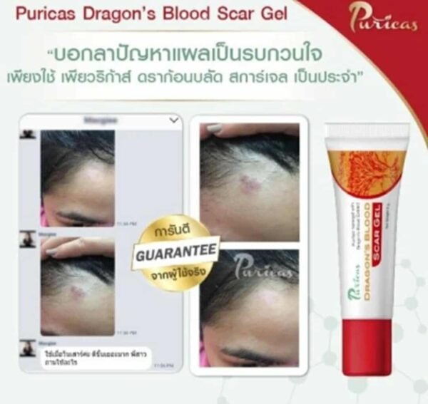 Puricas Natural Dragon's Blood Scar Gel Treat Keloid Surgery Acne Scars 9g - Image 3