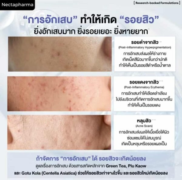 Nectapharma Pearletane anti ance supplementary - Image 5
