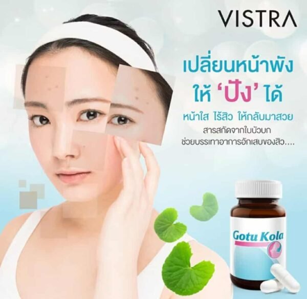 Vistra Gotu Kola Extract Plus Zinc for acne - Image 7