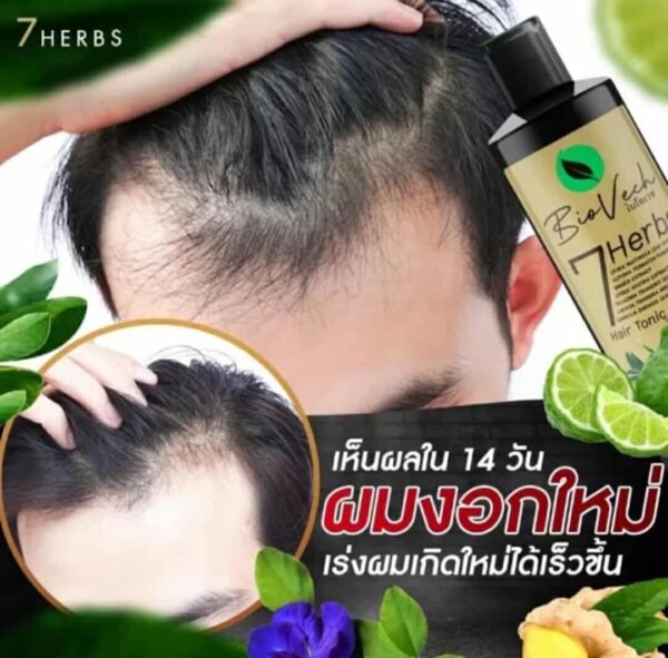Biovech shampoo hair care for hair growth - Image 6