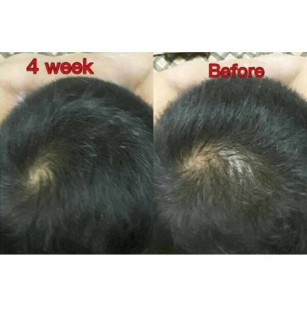 Nuhair Hair Loss Alopecia Hair Lotion Hair Growth lotion - Image 2