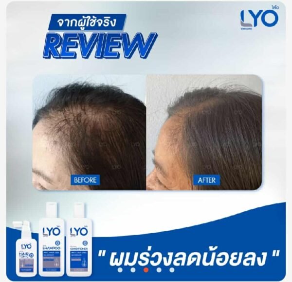 Lyo hair conditioner for anti hair loss - Image 9