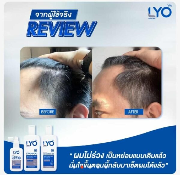 Lyo hair conditioner for anti hair loss - Image 8