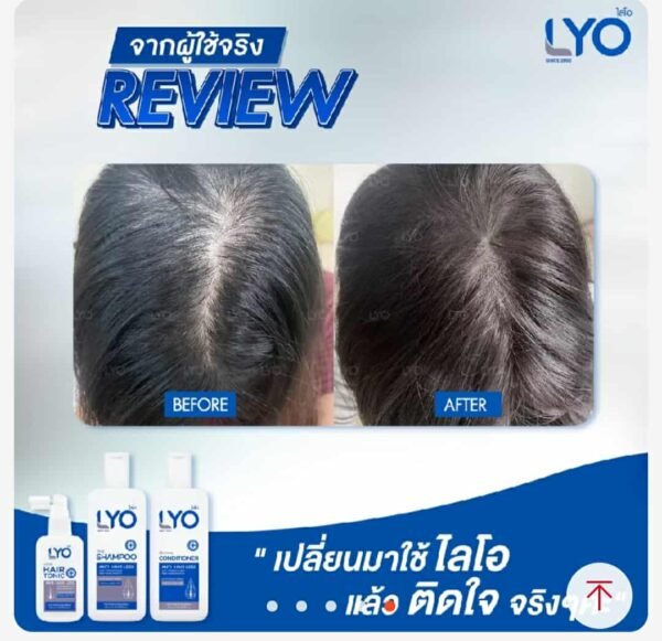 Lyo hair conditioner for anti hair loss - Image 6
