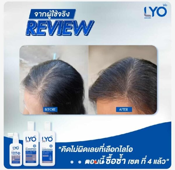 Lyo hair conditioner for anti hair loss - Image 5