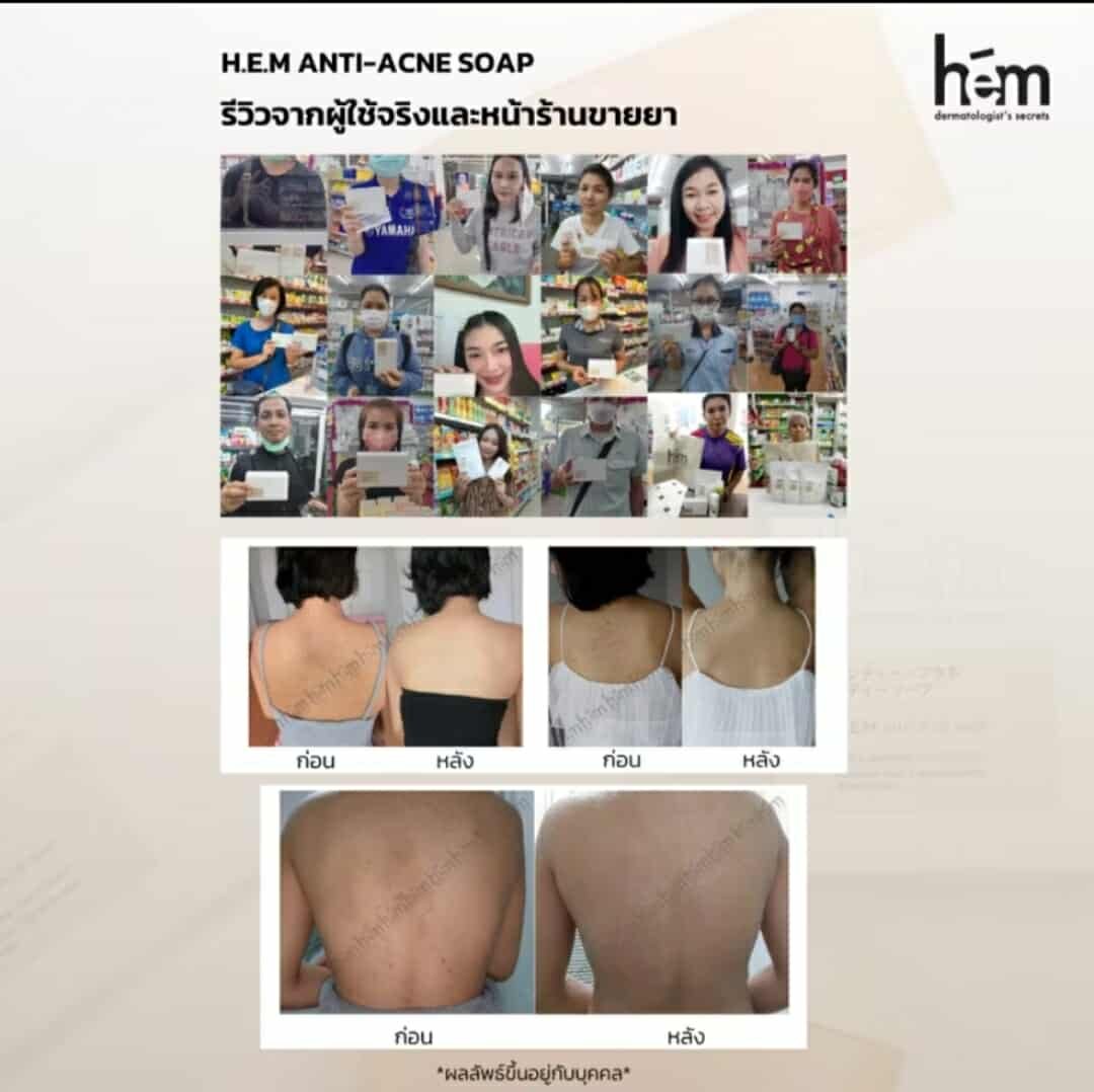 H.E.M. Anti-Acne Soap for face and body - Image 7