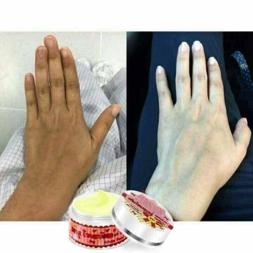 Soom U ginseng body whitening cream 2 boxes - Image 5